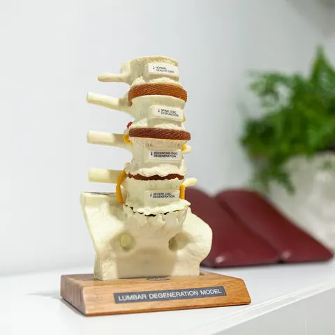 Spine model at Palm Beach Chiropractic Gold Coast
