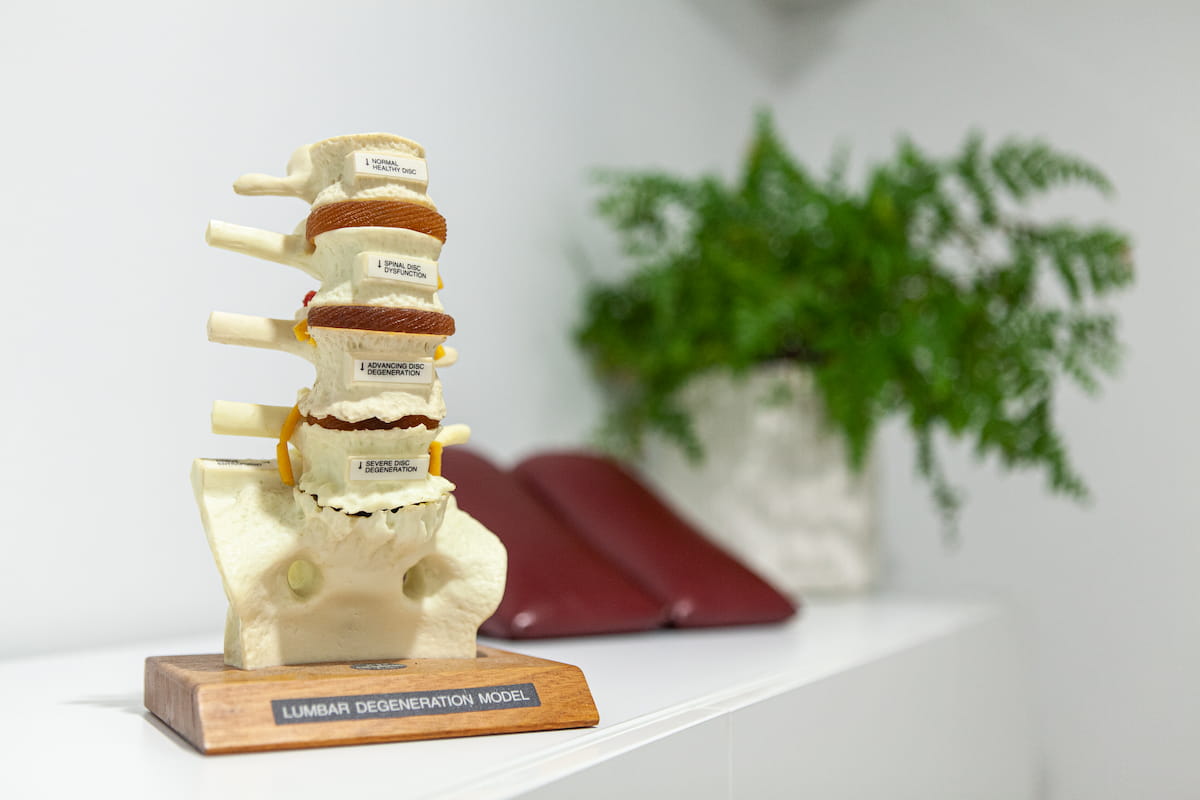 Spine model at Palm Beach Chiropractic Gold Coast